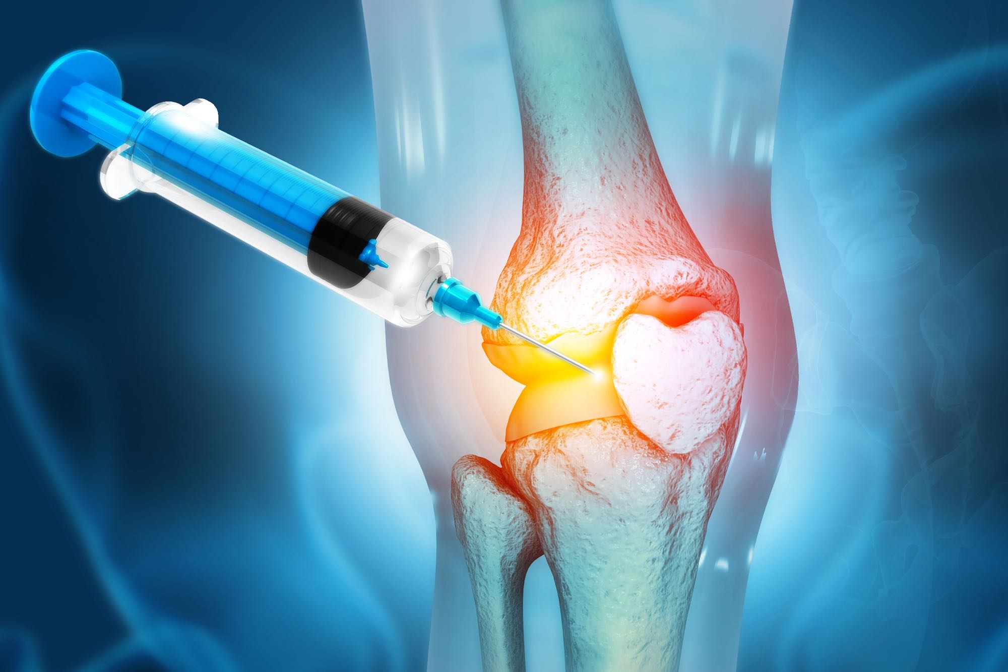 is stem cell therapy safe
